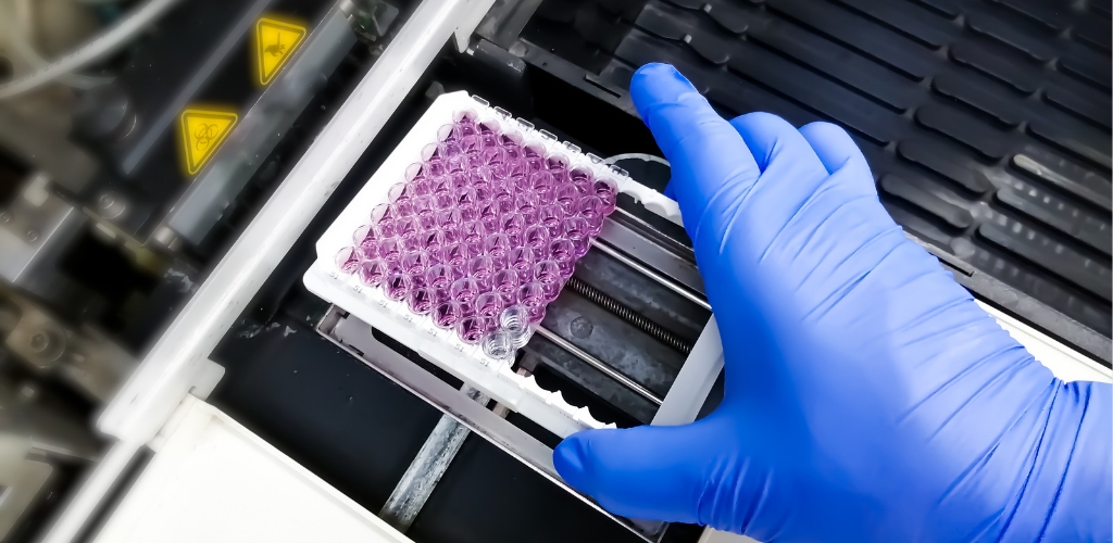 Next-Generation Sequencing Assays for Cancer Patients