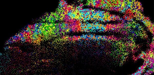 Understanding Spatial Transcriptomics: Mapping Gene Expression in ...
